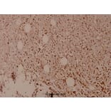 Anti-MDM2 (phospho-S166) Antibody from Bioworld Technology (BS4273) - Antibodies.com