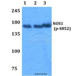 Anti-NOS1 (phospho-S852) Antibody from Bioworld Technology (BS4274) - Antibodies.com