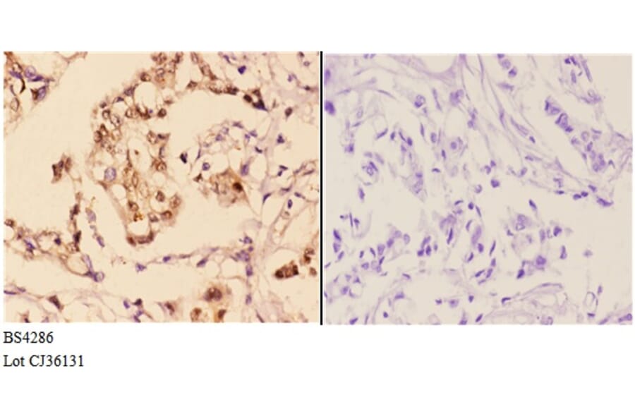 Anti-AKT1 (phospho-S246) Antibody from Bioworld Technology (BS4286) - Antibodies.com