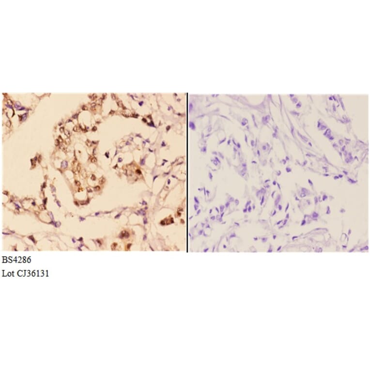 Anti-AKT1 (phospho-S246) Antibody from Bioworld Technology (BS4286) - Antibodies.com