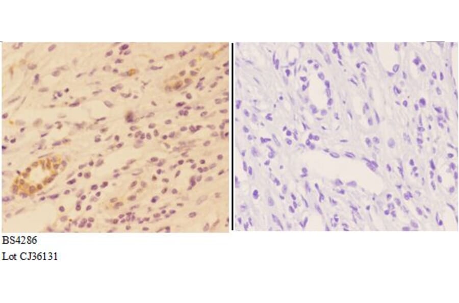 Anti-AKT1 (phospho-S246) Antibody from Bioworld Technology (BS4286) - Antibodies.com