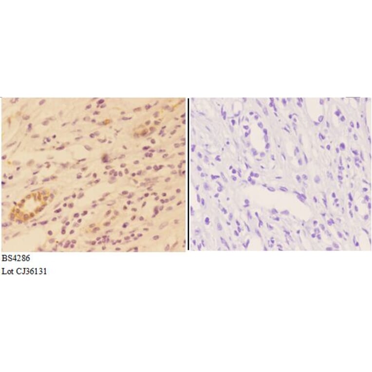Anti-AKT1 (phospho-S246) Antibody from Bioworld Technology (BS4286) - Antibodies.com