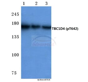 Anti-TBC1D4 (phospho-T642) Antibody from Bioworld Technology (BS4293) - Antibodies.com