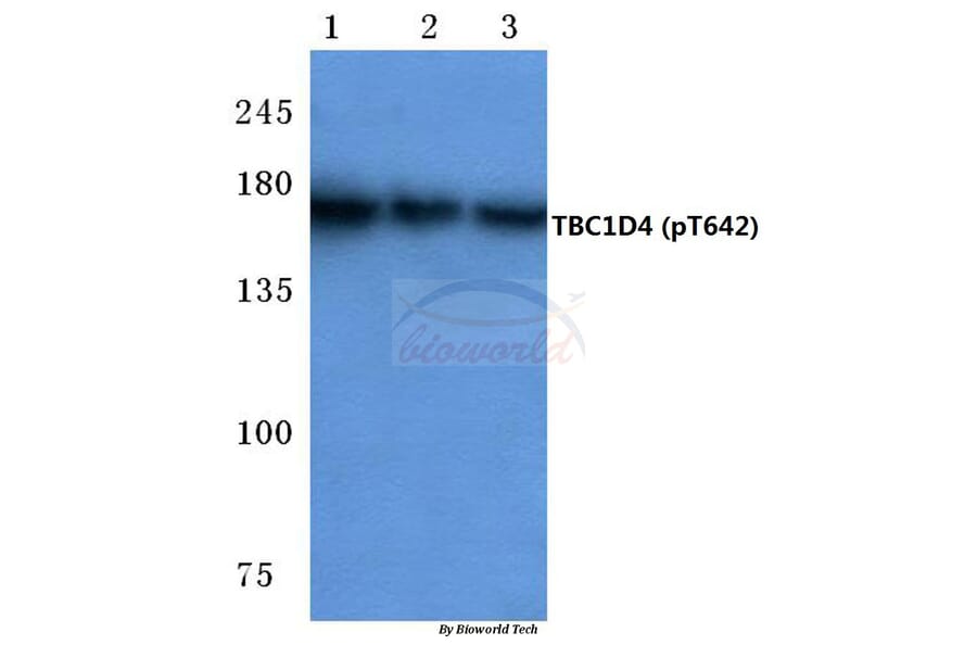 Anti-TBC1D4 (phospho-T642) Antibody from Bioworld Technology (BS4293) - Antibodies.com