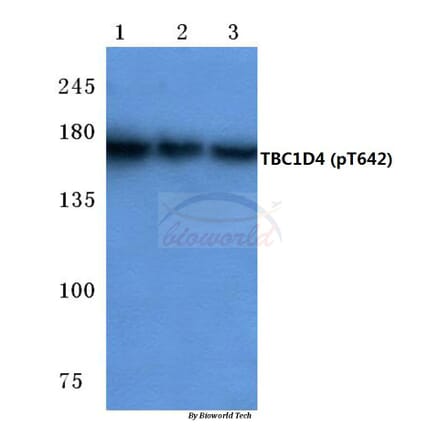 Anti-TBC1D4 (phospho-T642) Antibody from Bioworld Technology (BS4293) - Antibodies.com