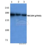 Anti-TBC1D4 (phospho-T642) Antibody from Bioworld Technology (BS4293) - Antibodies.com