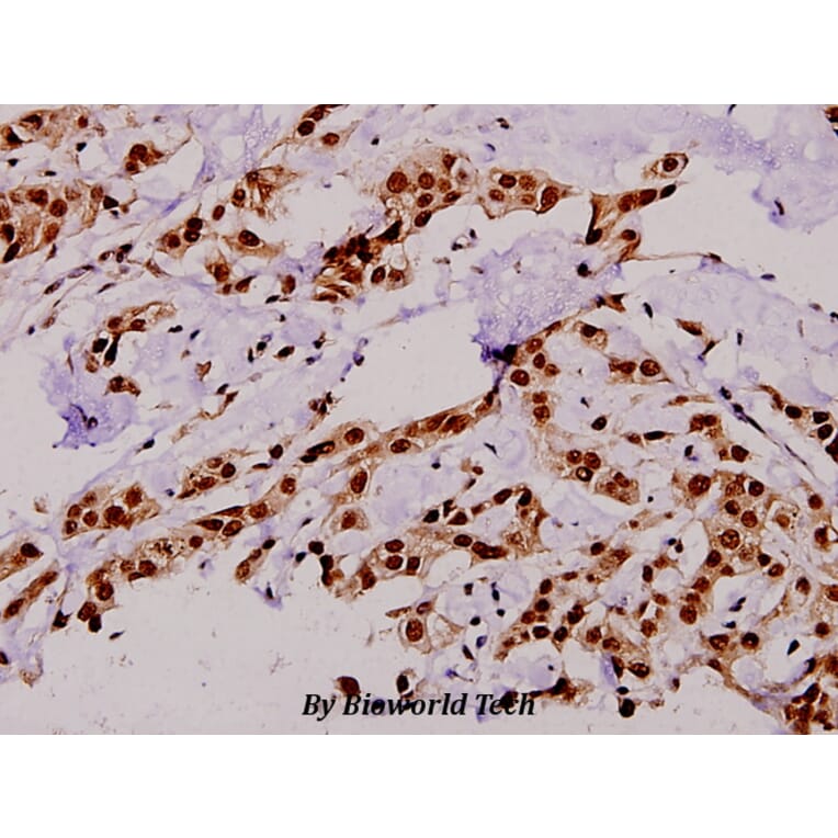Anti-TBC1D4 (phospho-T642) Antibody from Bioworld Technology (BS4293) - Antibodies.com