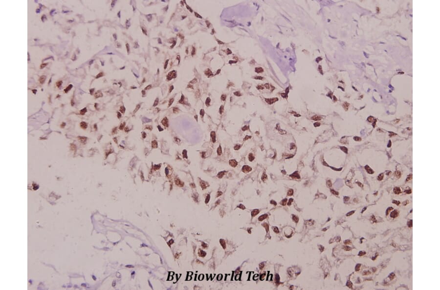 Anti-Bcl-2 (phospho-T69) Antibody from Bioworld Technology (BS4294) - Antibodies.com
