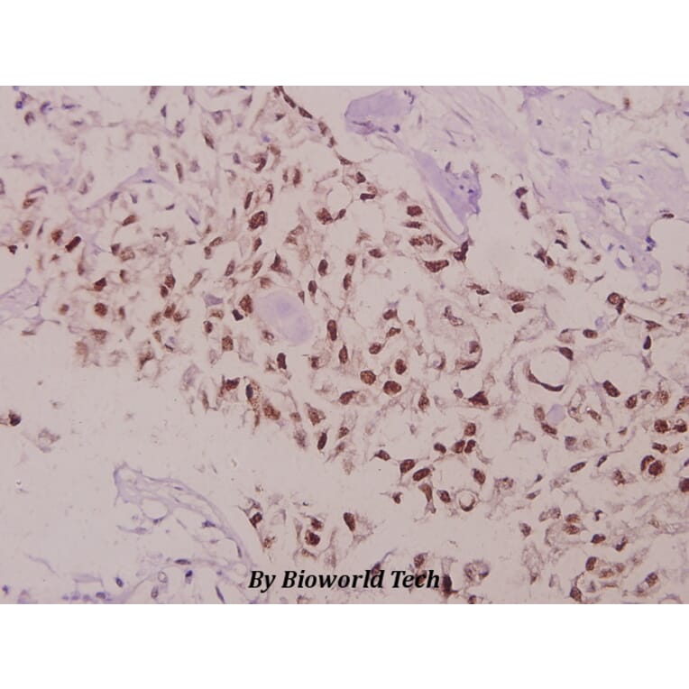 Anti-Bcl-2 (phospho-T69) Antibody from Bioworld Technology (BS4294) - Antibodies.com