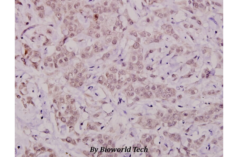 Anti-Bcl-X (phospho-T47) Antibody from Bioworld Technology (BS4295) - Antibodies.com