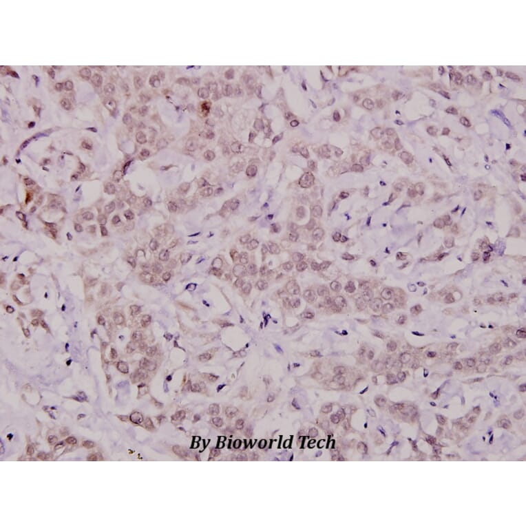 Anti-Bcl-X (phospho-T47) Antibody from Bioworld Technology (BS4295) - Antibodies.com
