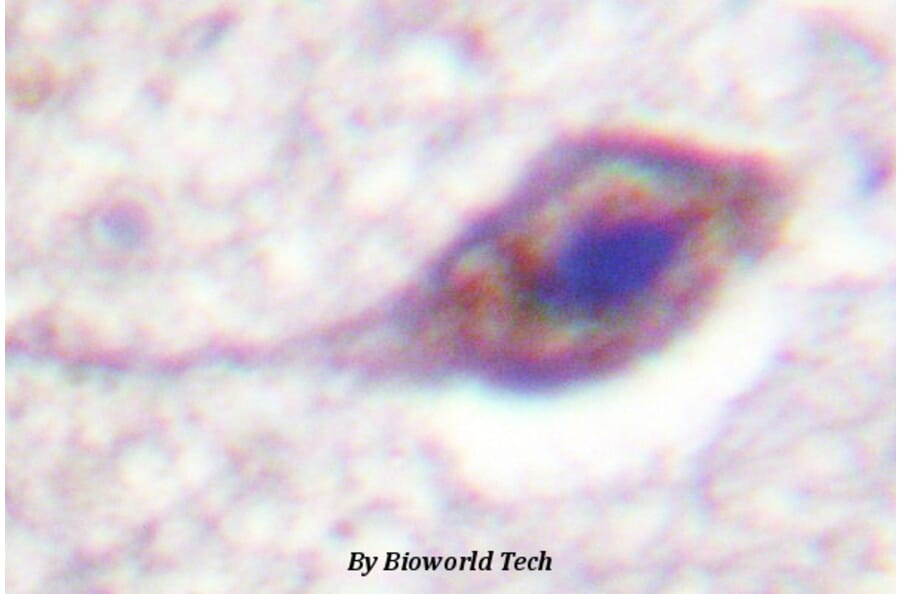 Anti-BID (phospho-S78) Antibody from Bioworld Technology (BS4297) - Antibodies.com