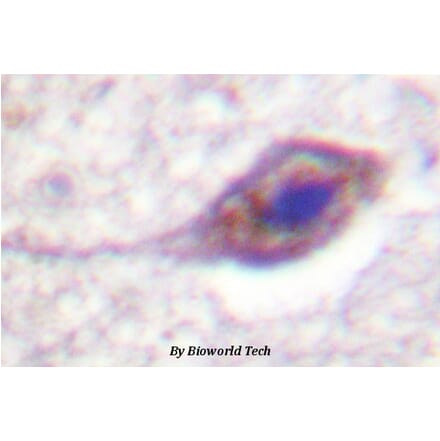 Anti-BID (phospho-S78) Antibody from Bioworld Technology (BS4297) - Antibodies.com