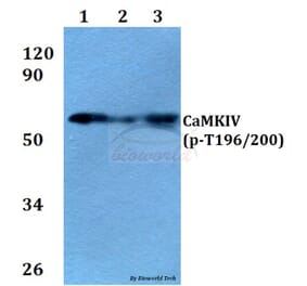 Anti-CaMKIV (phospho-T196/200) Antibody from Bioworld Technology (BS4300) - Antibodies.com
