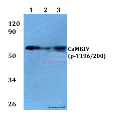 Anti-CaMKIV (phospho-T196/200) Antibody from Bioworld Technology (BS4300) - Antibodies.com