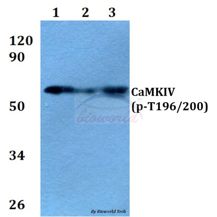 Anti-CaMKIV (phospho-T196/200) Antibody from Bioworld Technology (BS4300) - Antibodies.com