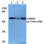 Anti-CaMKIV (phospho-T196/200) Antibody from Bioworld Technology (BS4300) - Antibodies.com
