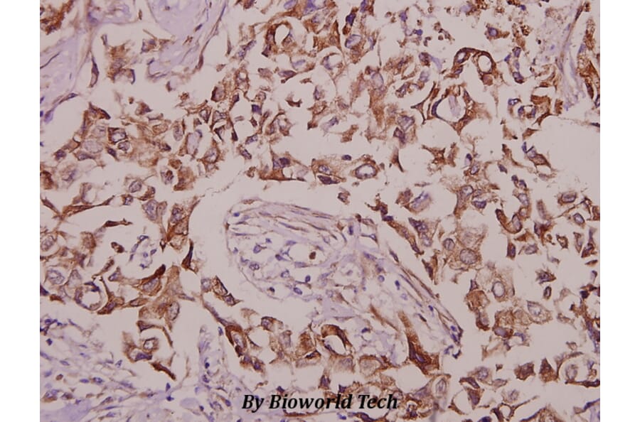 Anti-CaMKIV (phospho-T196/200) Antibody from Bioworld Technology (BS4300) - Antibodies.com