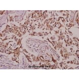 Anti-CaMKIV (phospho-T196/200) Antibody from Bioworld Technology (BS4300) - Antibodies.com