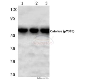 Anti-Catalase (phospho-Y385) Antibody from Bioworld Technology (BS4302) - Antibodies.com