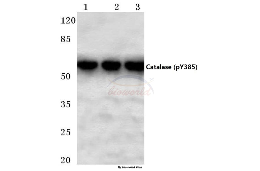 Anti-Catalase (phospho-Y385) Antibody from Bioworld Technology (BS4302) - Antibodies.com