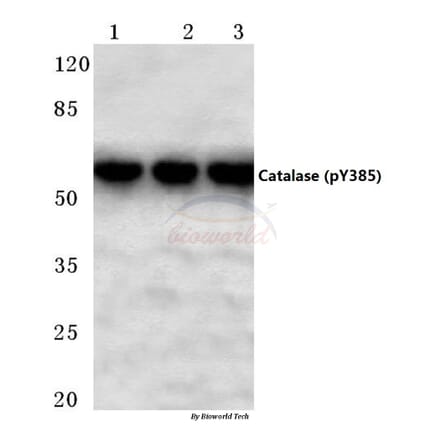 Anti-Catalase (phospho-Y385) Antibody from Bioworld Technology (BS4302) - Antibodies.com