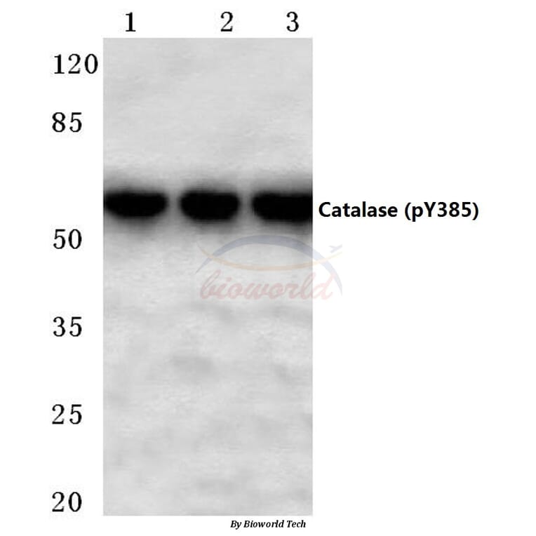 Anti-Catalase (phospho-Y385) Antibody from Bioworld Technology (BS4302) - Antibodies.com