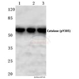 Anti-Catalase (phospho-Y385) Antibody from Bioworld Technology (BS4302) - Antibodies.com