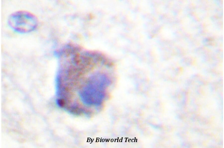 Anti-Catalase (phospho-Y385) Antibody from Bioworld Technology (BS4302) - Antibodies.com