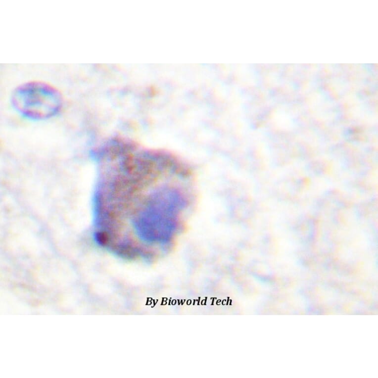 Anti-Catalase (phospho-Y385) Antibody from Bioworld Technology (BS4302) - Antibodies.com