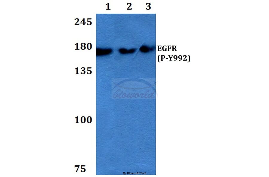 Anti-EGFR (phospho-Y992) Antibody from Bioworld Technology (BS4310) - Antibodies.com