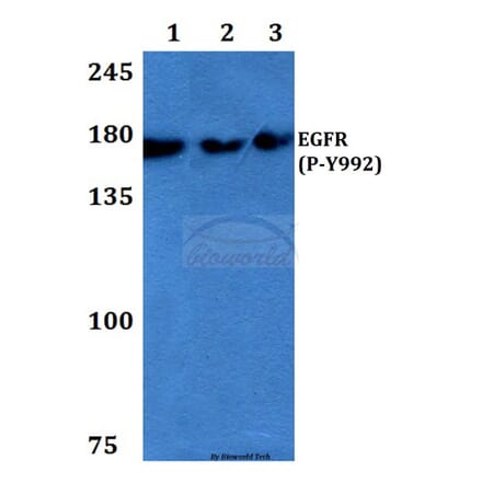 Anti-EGFR (phospho-Y992) Antibody from Bioworld Technology (BS4310) - Antibodies.com