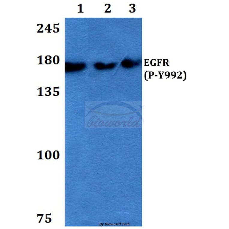 Anti-EGFR (phospho-Y992) Antibody from Bioworld Technology (BS4310) - Antibodies.com