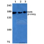 Anti-EGFR (phospho-Y992) Antibody from Bioworld Technology (BS4310) - Antibodies.com