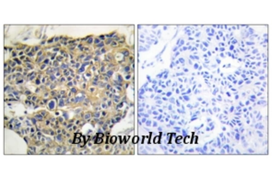 Anti-EGFR (phospho-Y992) Antibody from Bioworld Technology (BS4310) - Antibodies.com