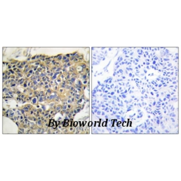 Anti-EGFR (phospho-Y992) Antibody from Bioworld Technology (BS4310) - Antibodies.com