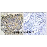 Anti-EGFR (phospho-Y992) Antibody from Bioworld Technology (BS4310) - Antibodies.com