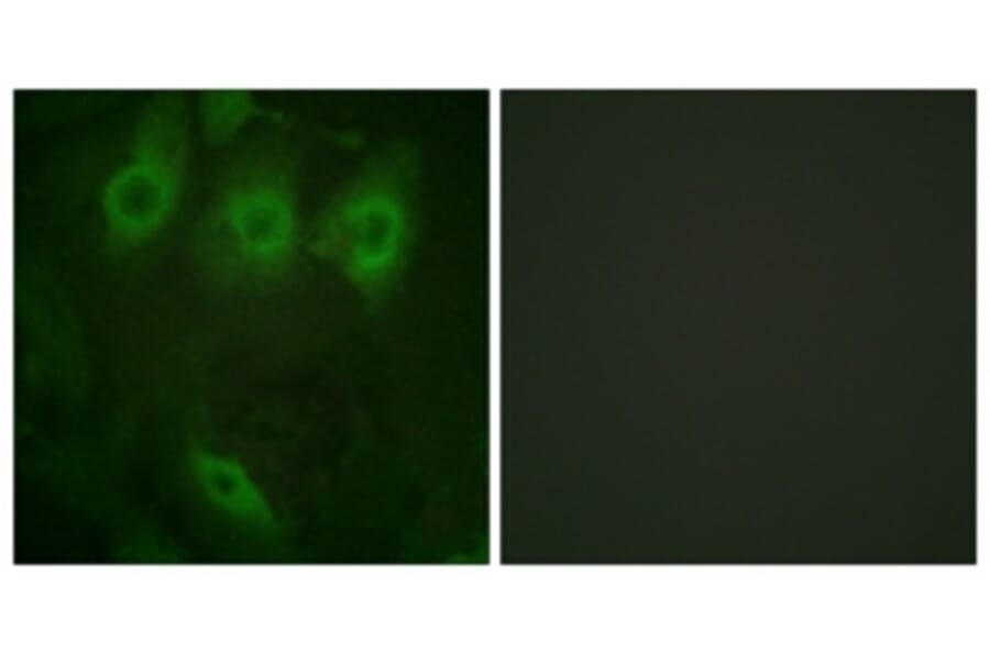 Anti-EGFR (phospho-Y992) Antibody from Bioworld Technology (BS4310) - Antibodies.com