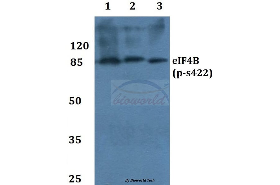 Anti-eIF4B (phospho-S422) Antibody from Bioworld Technology (BS4311) - Antibodies.com