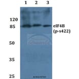 Anti-eIF4B (phospho-S422) Antibody from Bioworld Technology (BS4311) - Antibodies.com