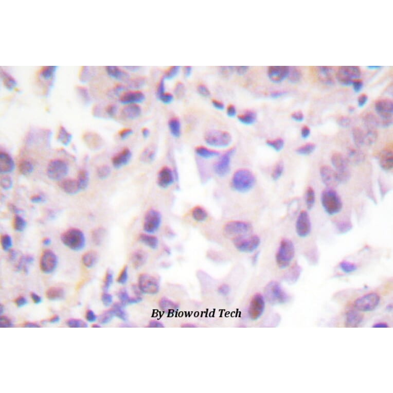 Anti-ERF (phospho-T526) Antibody from Bioworld Technology (BS4312) - Antibodies.com