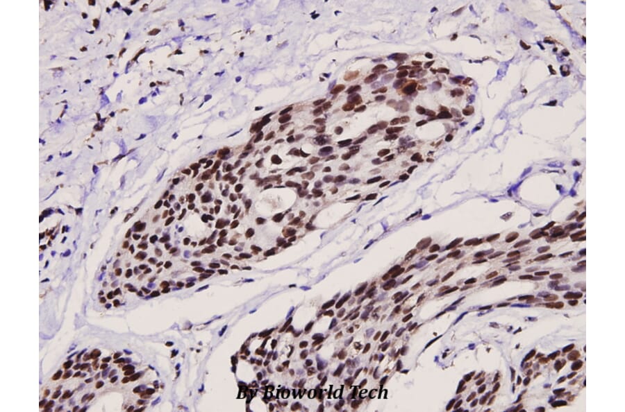 Anti-Ets-1 (phospho-T38) Antibody from Bioworld Technology (BS4316) - Antibodies.com