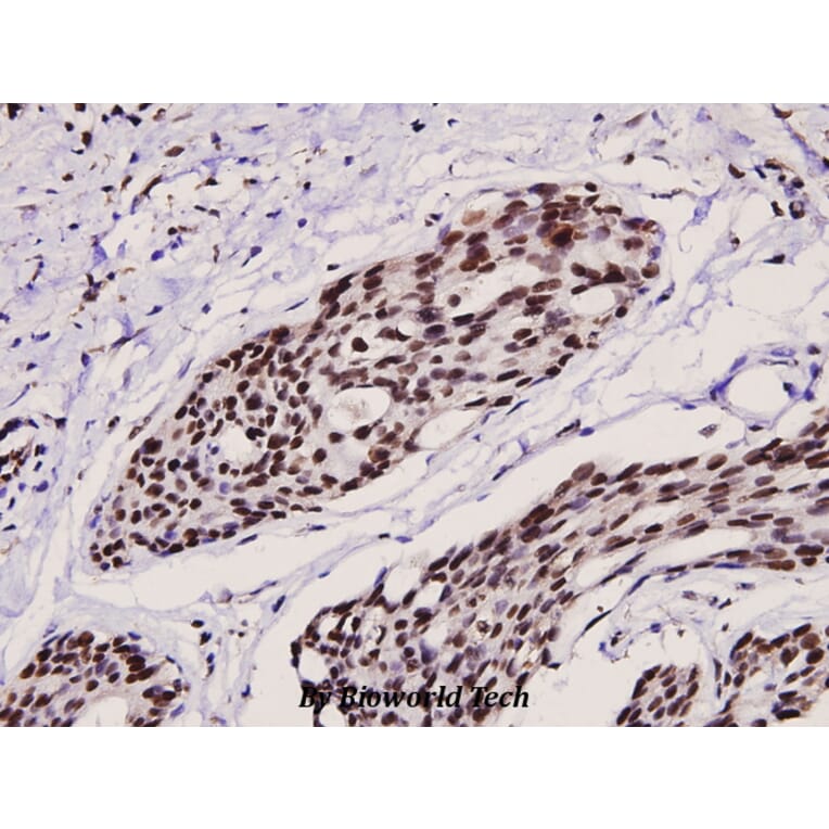 Anti-Ets-1 (phospho-T38) Antibody from Bioworld Technology (BS4316) - Antibodies.com