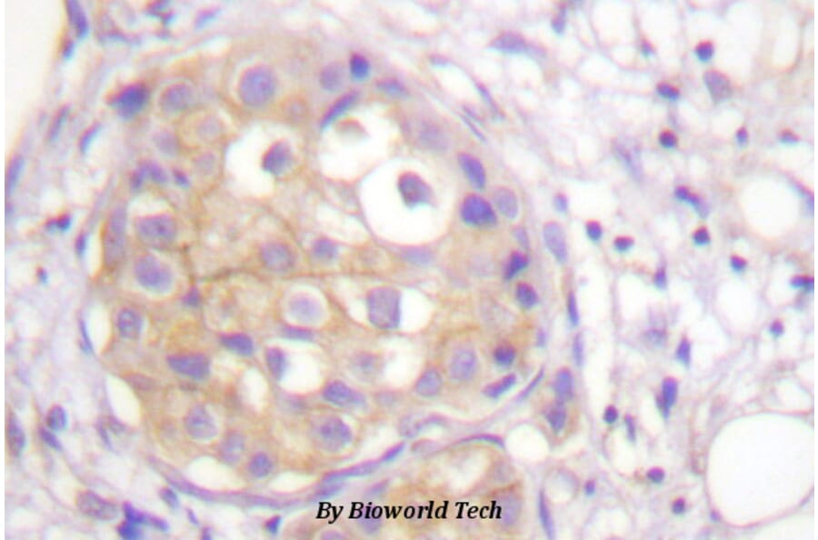 Anti-FGFR1 (phospho-Y766) Antibody from Bioworld Technology (BS4318) - Antibodies.com