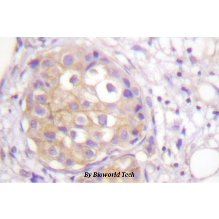 Anti-FGFR1 (phospho-Y766) Antibody from Bioworld Technology (BS4318) - Antibodies.com