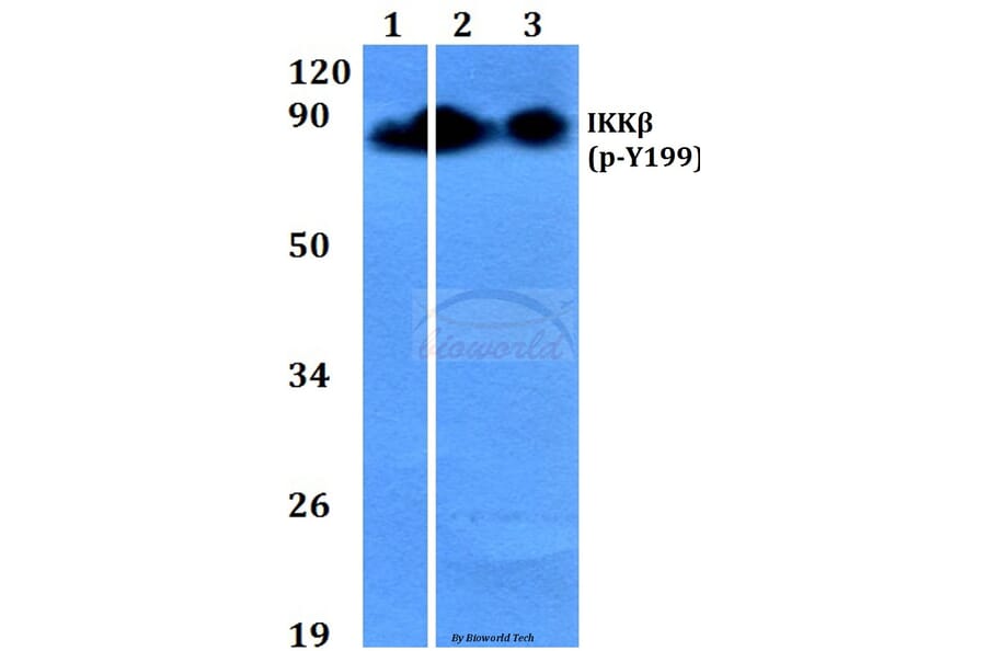 Anti-IKKβ (phospho-Y199) Antibody from Bioworld Technology (BS4320) - Antibodies.com