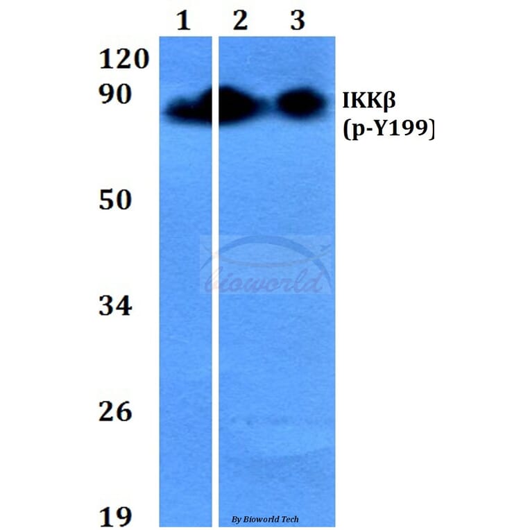 Anti-IKKβ (phospho-Y199) Antibody from Bioworld Technology (BS4320) - Antibodies.com