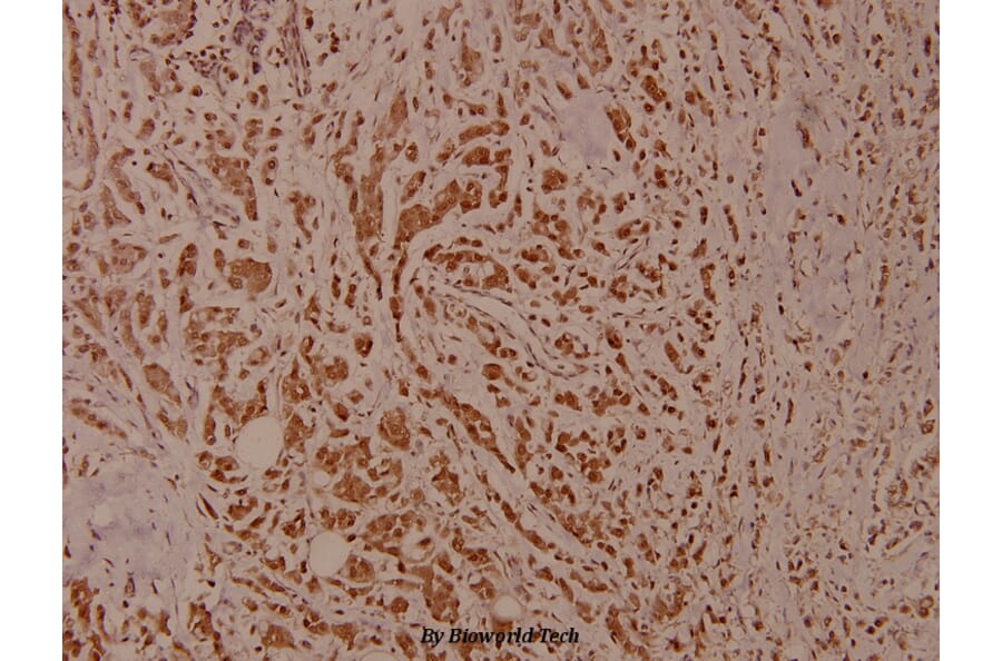 Anti-IKKβ (phospho-Y199) Antibody from Bioworld Technology (BS4320) - Antibodies.com