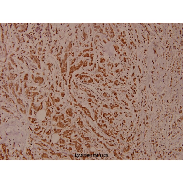 Anti-IKKβ (phospho-Y199) Antibody from Bioworld Technology (BS4320) - Antibodies.com