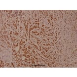 Anti-IKKβ (phospho-Y199) Antibody from Bioworld Technology (BS4320) - Antibodies.com